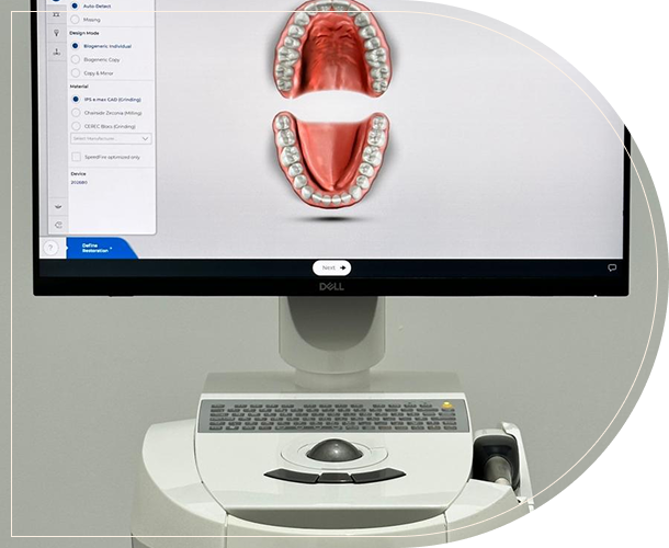 intraoral digital 3d impressions