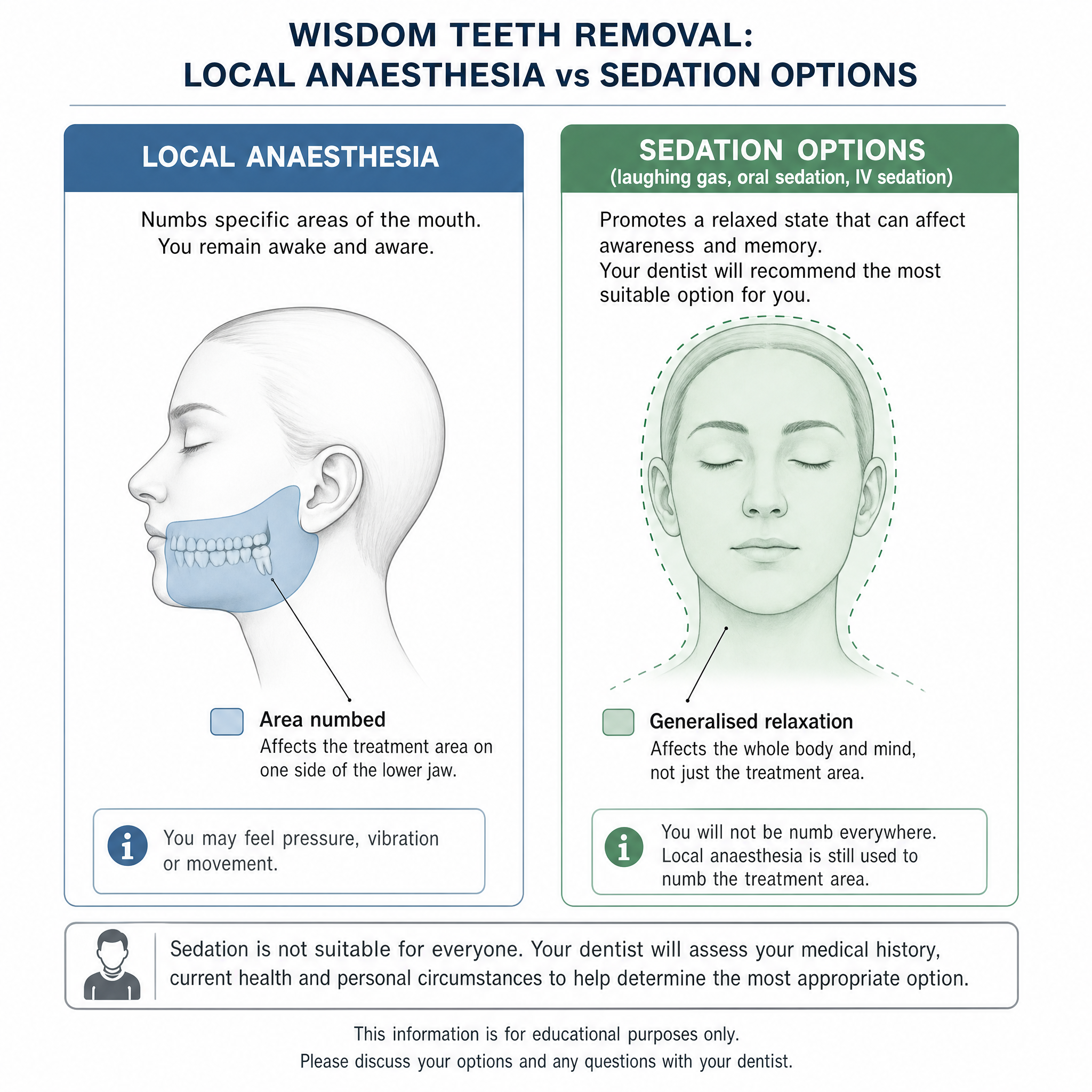 Educational comparison of local anaesthesia and sedation options for wisdom teeth removal